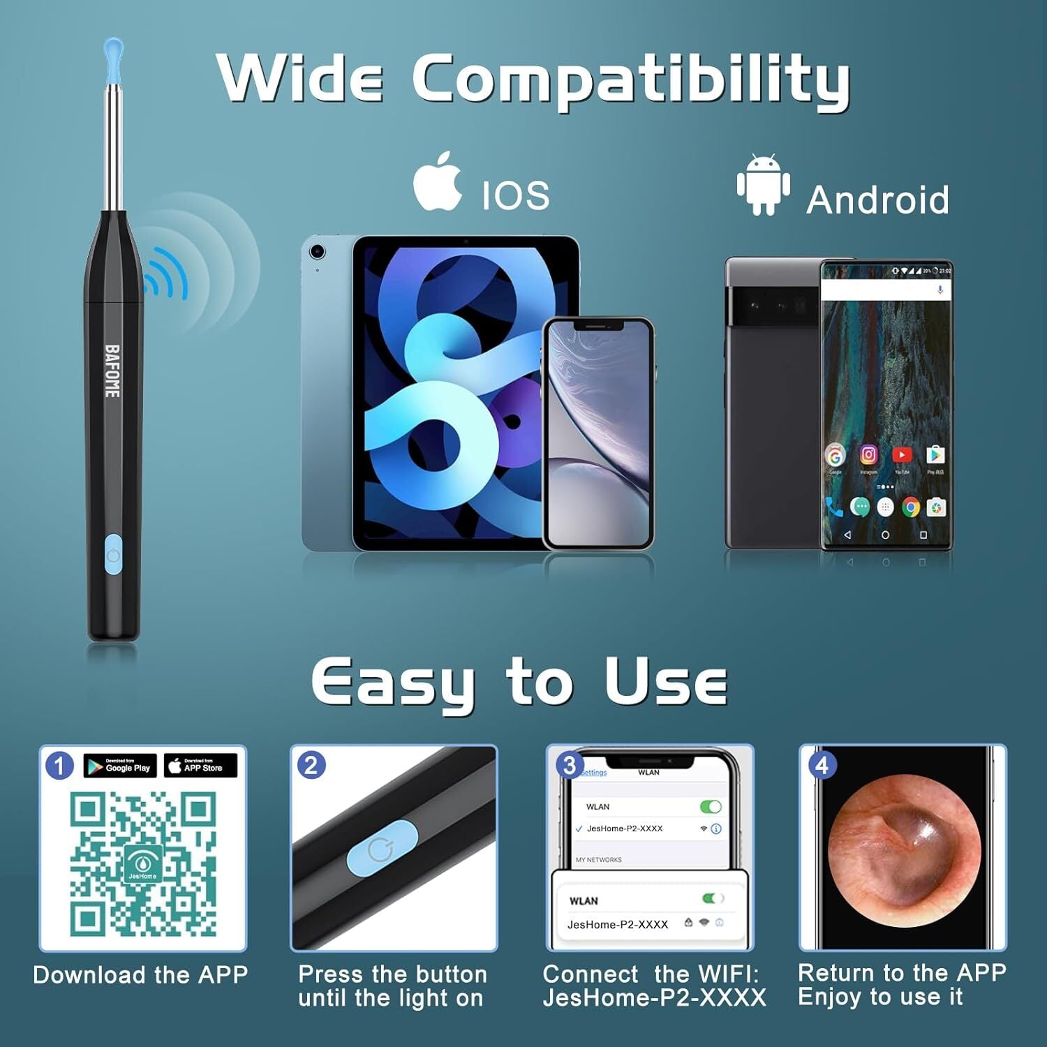 Ear Wax Removal, Ear Cleaner with Camera, 1920HD Ear Cleaner, Ear Wax Removal To