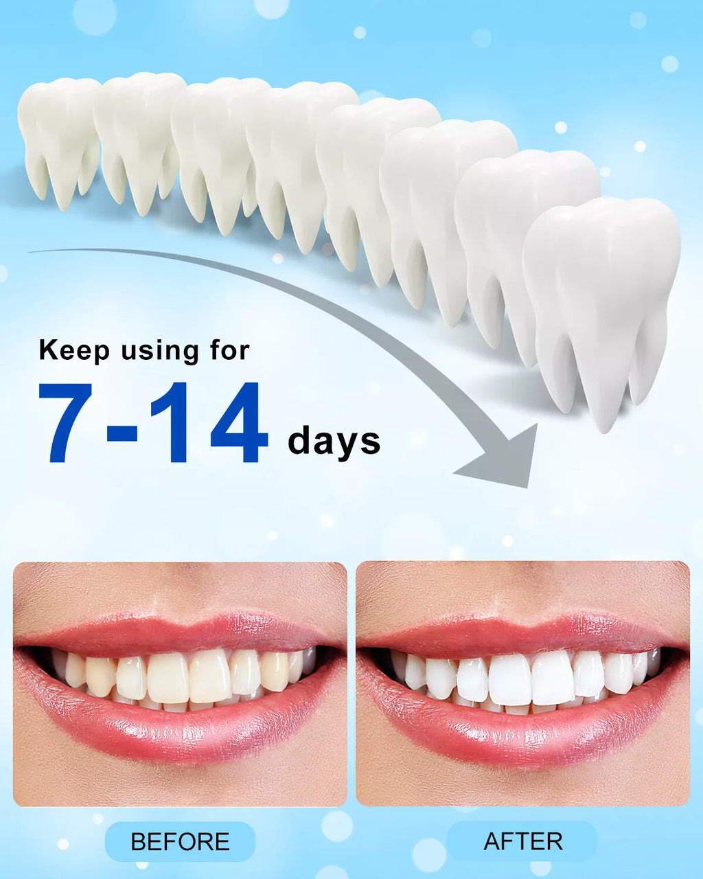28-LED Powerful Teeth Whitening Light Tray with 4Ml Sample Teeth Whitening Gel, IPX7 Waterproof Rechargeable Tooth Whitener Accelerator